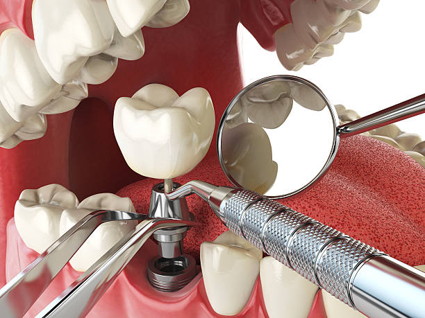 Best Emergency Broken Tooth Repair in Stillwater, OK